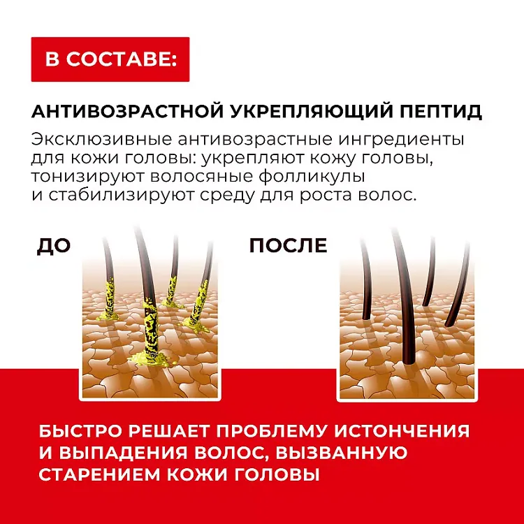 Scalp Oil-Controlling Shampoo - ШАМПУНЬ С ПЕПТИДАМИ И ПРЕБИОТИКАМИ ДЛЯ ЖИРНЫХ ВОЛОС, 500 г